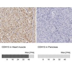 Cadherin-13 Antibody, Novus Biologicals 0.1mL; Unlabeled:Antibodies, Polyclonal